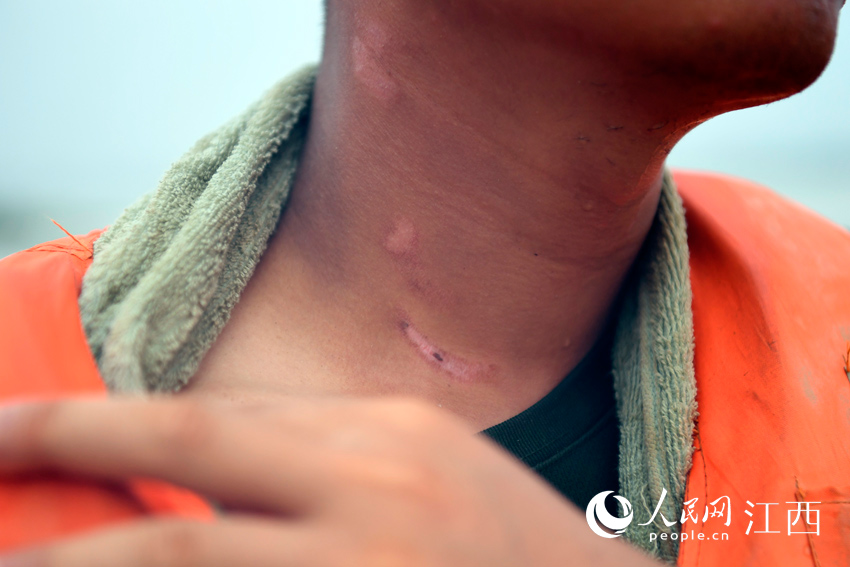 �B�m��ɳ������ʿ�����ϵ�Ƥĥ������Ĩˎ�����ڿ�������������W �r��/�z��